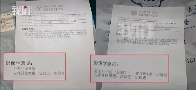 良性肿瘤变肝癌，山东一男子CT报告时隔8年出现反转，医院回应：家属取报告时间太早，次日才确定结论，确有未及时通知的问题，愿沟通赔偿