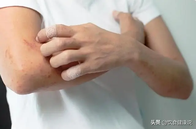 湿气的图片