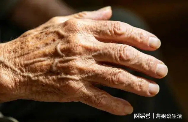 体内有癌，双手先知？提醒：手上出现5个变化，或是癌症来临信号